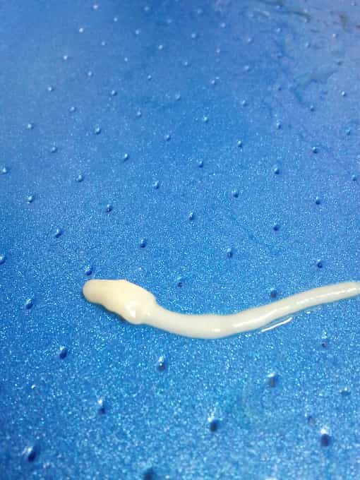 Alergia al gusano Anisakis